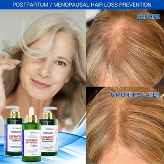Capsaicin Anti Hairloss Shampoo for Hair Growth and Hair Thinning PreventionScalp-Stimulating & Follicle Strengthening by Botanical Green Lab