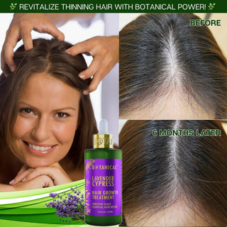 Lavender Hair Growth Treatment for hair loss and hair thinning prevention calming & follicle-stimulating serum before and after by Botanical Green Lab