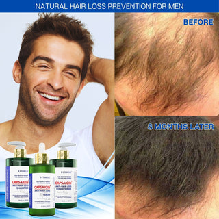 Conditioner For Thinning Hair -  Capsaicin Dandruff & Hair Thinning Prevention Formula