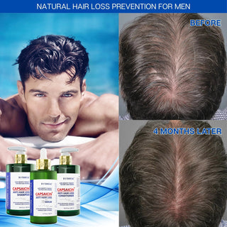 Conditioner For Thinning Hair -  Capsaicin Dandruff & Hair Thinning Prevention Formula