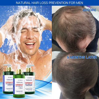 Conditioner For Thinning Hair -  Capsaicin Dandruff & Hair Thinning Prevention Formula