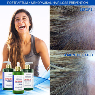 Conditioner For Thinning Hair -  Capsaicin Dandruff & Hair Thinning Prevention Formula