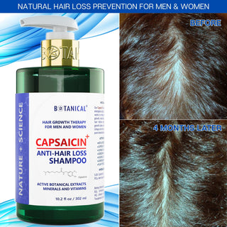 Conditioner For Thinning Hair -  Capsaicin Dandruff & Hair Thinning Prevention Formula